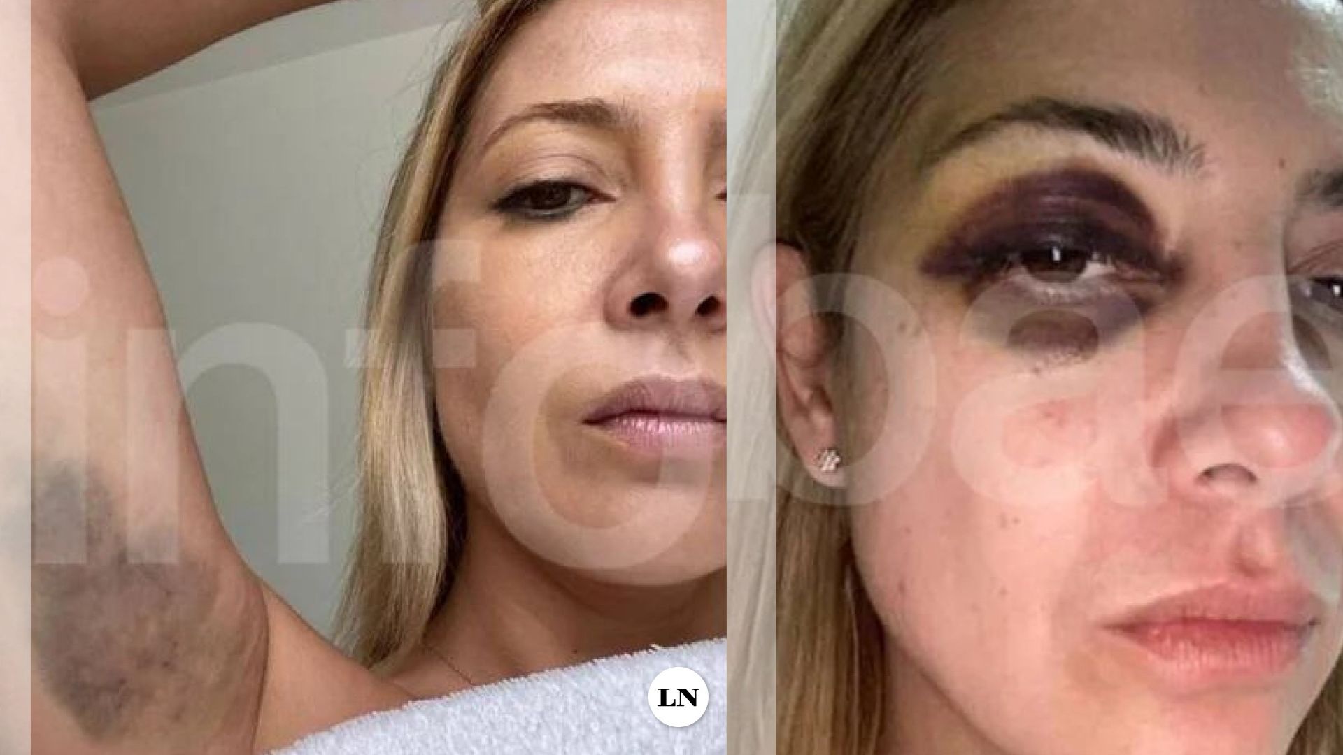 Infobae: Fabiola Yañez denuncia a Alberto Fernández por violencia de género con pruebas gráficas y chats