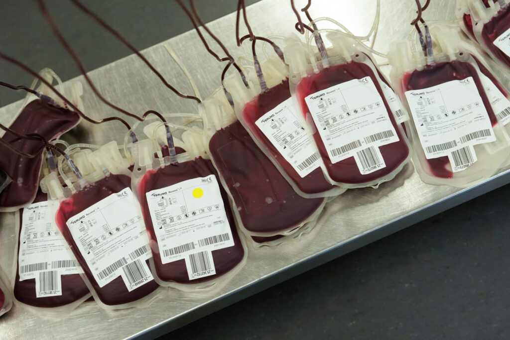 Demuestran los beneficios de transfundir sangre de cordón umbilical a prematuros extremos